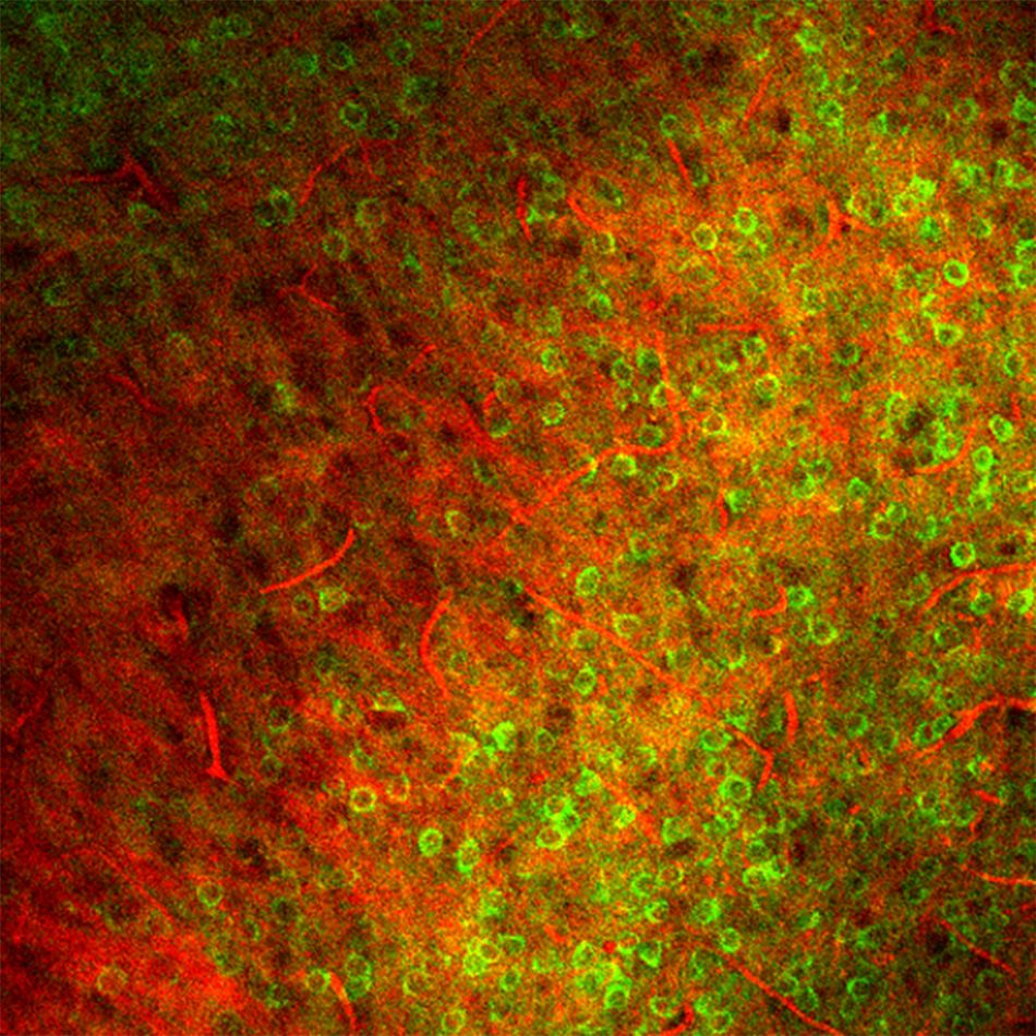 3-photon imaging of mouse primary visual cortex through densely-labelled tissue. Green signal is expression of GCaMP6f; red channel is third harmonic signal generated by both white matter and vasculature. Excitation was done by Coherent Monaco/OPerA at 1300nm. Image courtesy of J. Reimer and A. Tolias (Baylor College of Medicine), and T. Wang, D. Ouzounov, and C. Xu (Cornell)